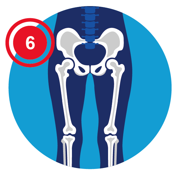 Hip and knee pain