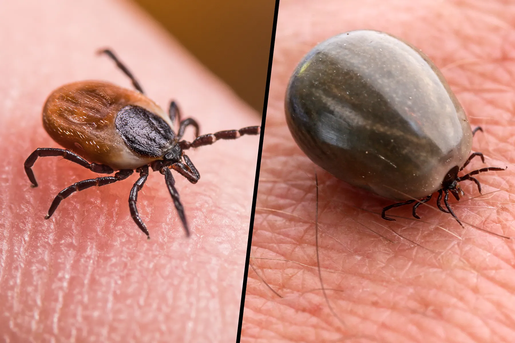 Ticks, tick bites, and what diseases do they spread.