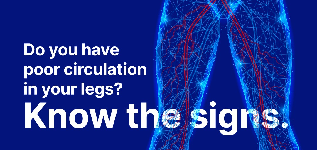 A vascular stock graphic, showing veins in a persons lower body.